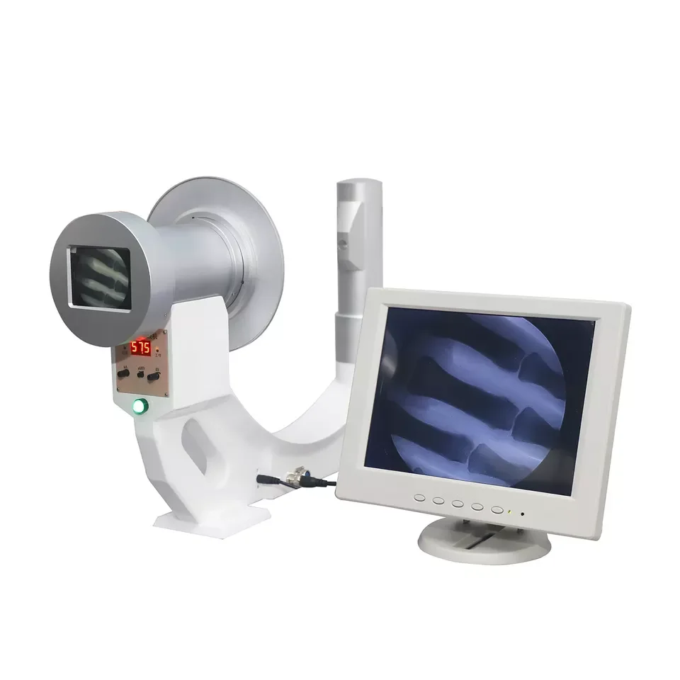 High Quality Medical Mini X-ray Machine Portable for Hospital Fluoroscopy X Ray Machine