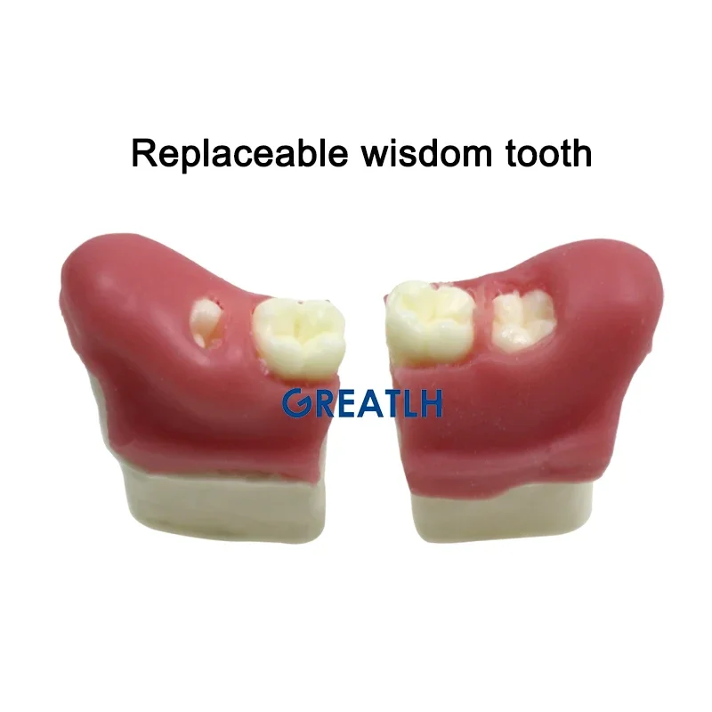 GREATLH Dental Wisdom Tooth Extraction Model Impacted Tooth Extraction Model Soft Gum Dentisty Study Training Model Dental Tools