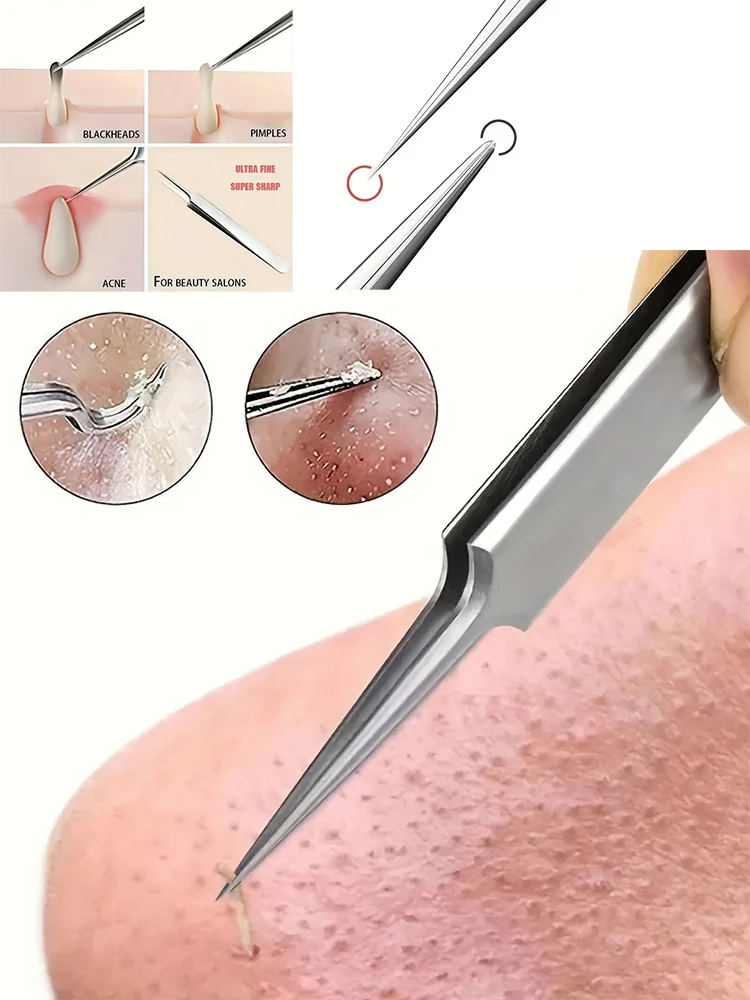 極細No.1パック 5 つの細胞ニキビにきびピンセット - 顔の美しさを除去するニキビ針ツール、スキンケア用