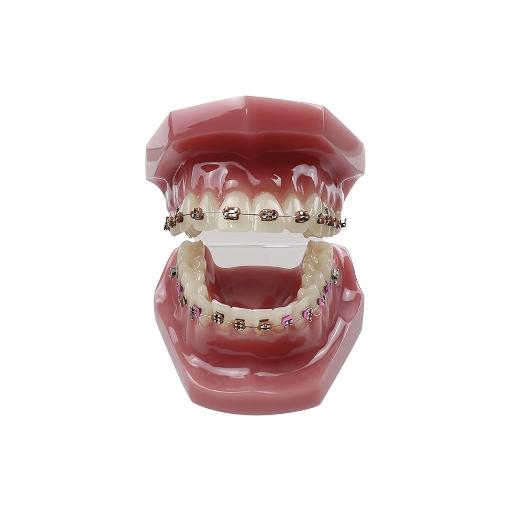 Orthodontic Teaching Model Implant Disease Dentist Studying for Dentist Doctor-patient  Restoration Bridge Demo Training Tool
