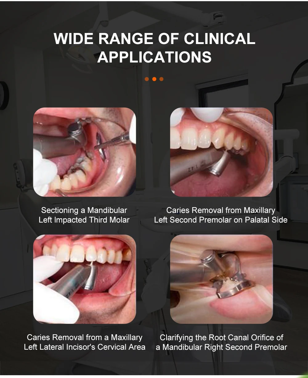 1:4,2 Vergrößernder roter Dental-Niedriggeschwindigkeits-Winkelstückadapter Z45L für elektrische Mikromotor-Dentalhandstücke, 45 Grad mit LED-Glasfaser – Detail 3
