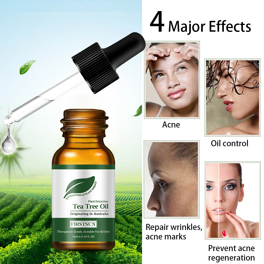 Tea Tree Oil Control To Pore Removal Acne Moisturizing Facial Acne Treatment Oil Whitening Brightening Facial Skin Care Products