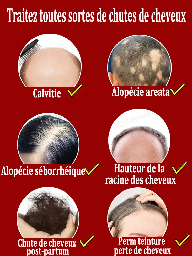 Los mejores productos para el crecimiento del cabello en 2024 para reparar eficazmente la calvicie y la caída del cabello