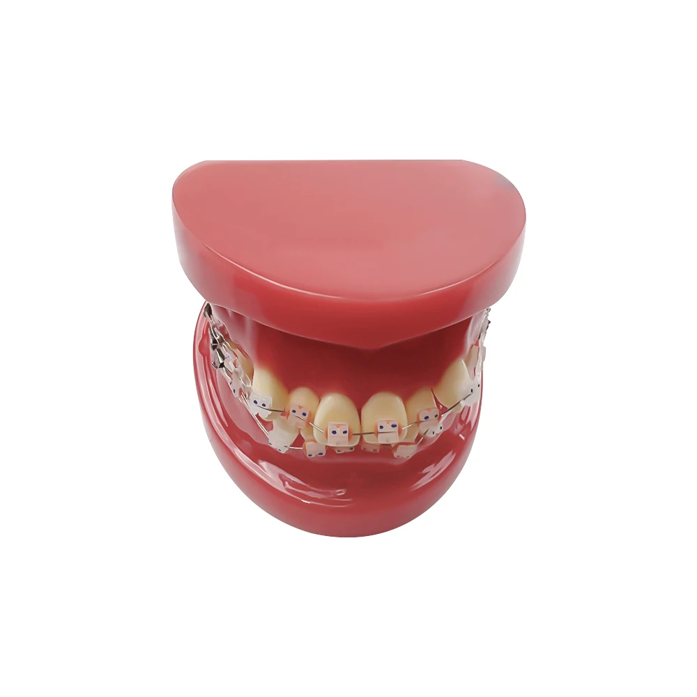 Modello ortodontico dentale con staffe in ceramica trattamento Ortho modello di denti modelli di laboratorio di odontoiatria per la comunicazione del paziente