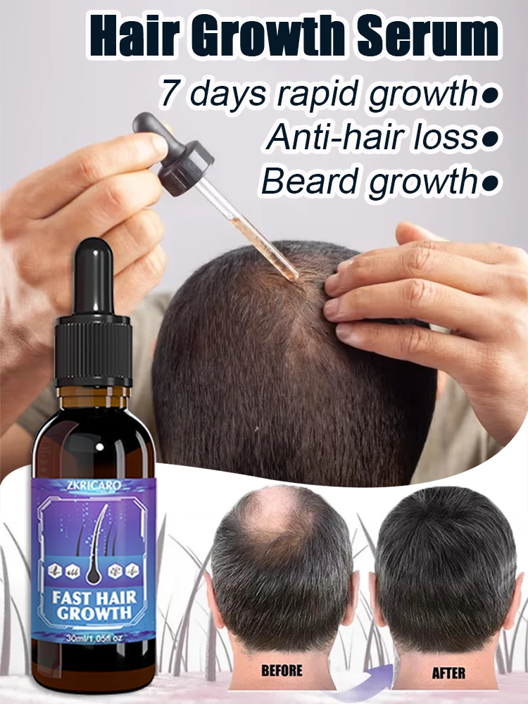 Hot selling product, 99% of buyers buy again, have more and more hair, say goodbye to baldness, thick hair