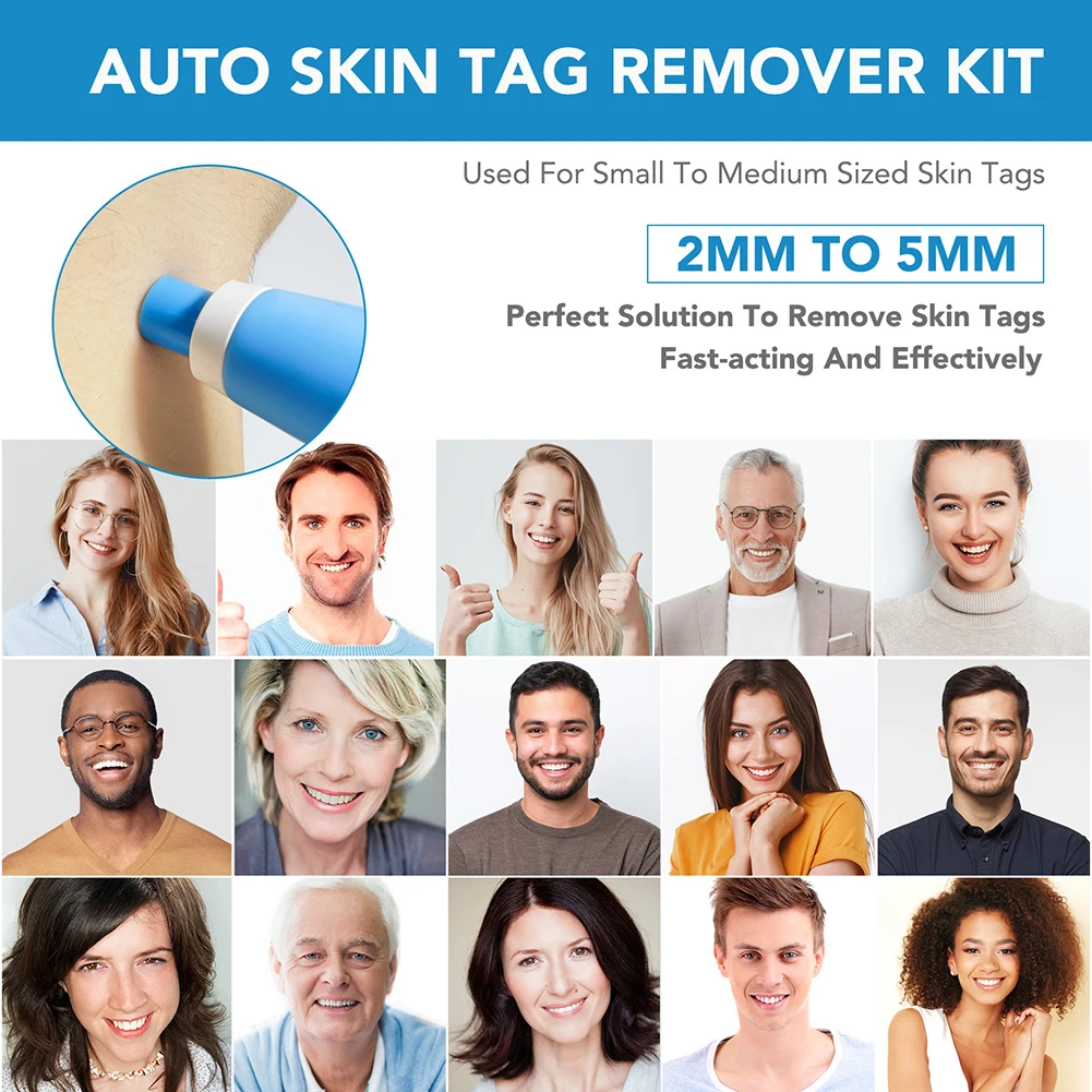 Rubber Rings Skin Tag Removal Device Face Beauty Accessories Remove Skin Wart Kits Multipurpose Supplies for Face Neck Chin Back view 5