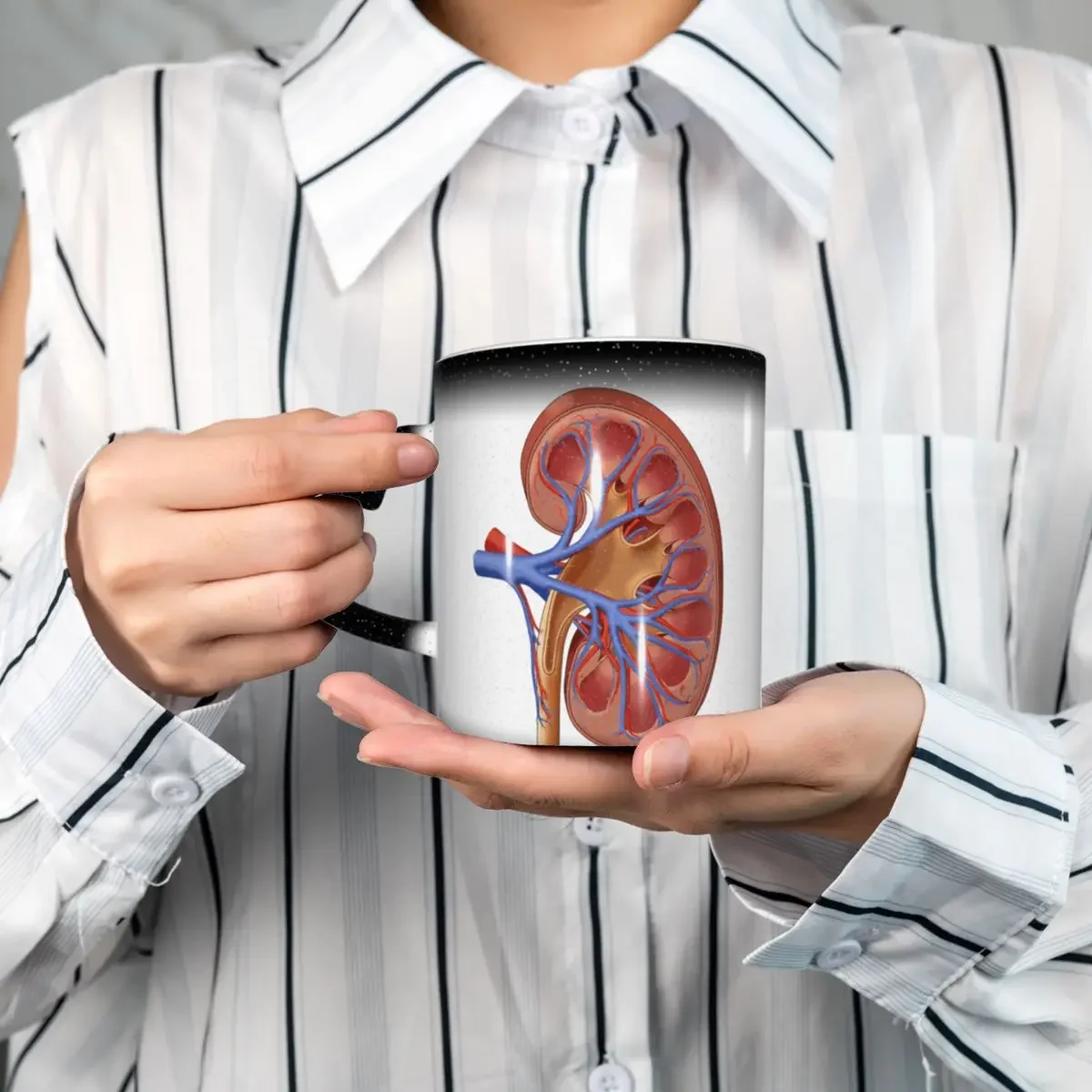 Medical Illustration Of Kidney Anatomy Mug Funny Ceramic Coffee Cups Tea Mugs Milk Cup Drinkware Gift for Woman Man