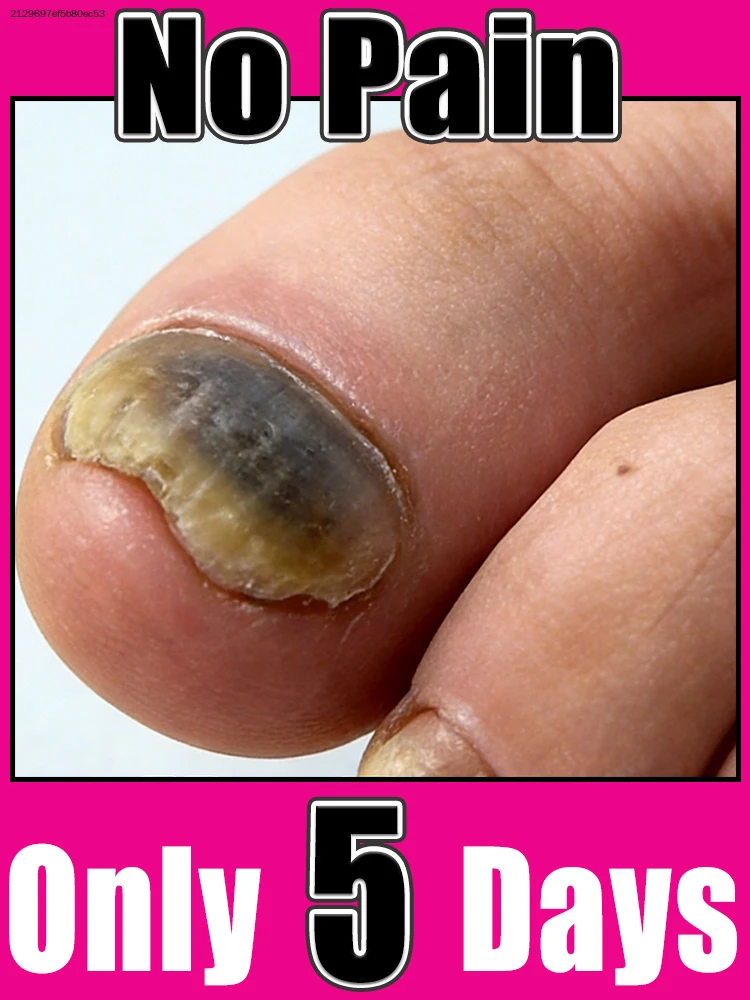 

2026 NEW Cleaning Nail Brush Tools Nail Art Manicureed Tool 2026 Hot Sale Foot Care Tools