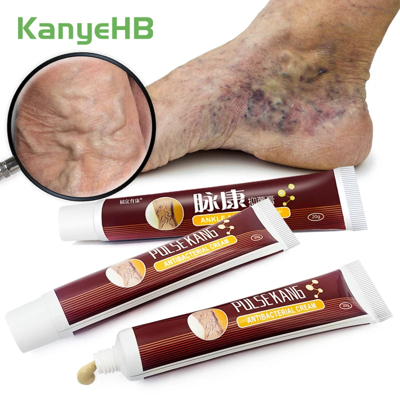 

3pcs Varicose Veins Cream Varicose Vein Treatment Ointment Relieve Vein Swelling Pain Remove Leg Varices Promote Blood Flow A429