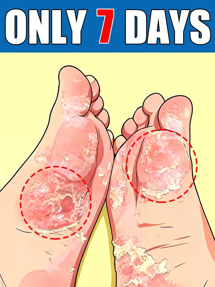 

Высокие рейтинги, бесплатная доставка, помощь людям, которые сосут липкости и дискомфорт решают их проблемы.