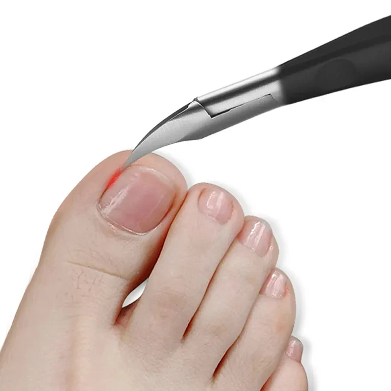 Cortador de unhas encravadas podologia correção pinças cortadores de cutícula corte paroníquia pedicure manicure mão ferramenta de cuidados com os