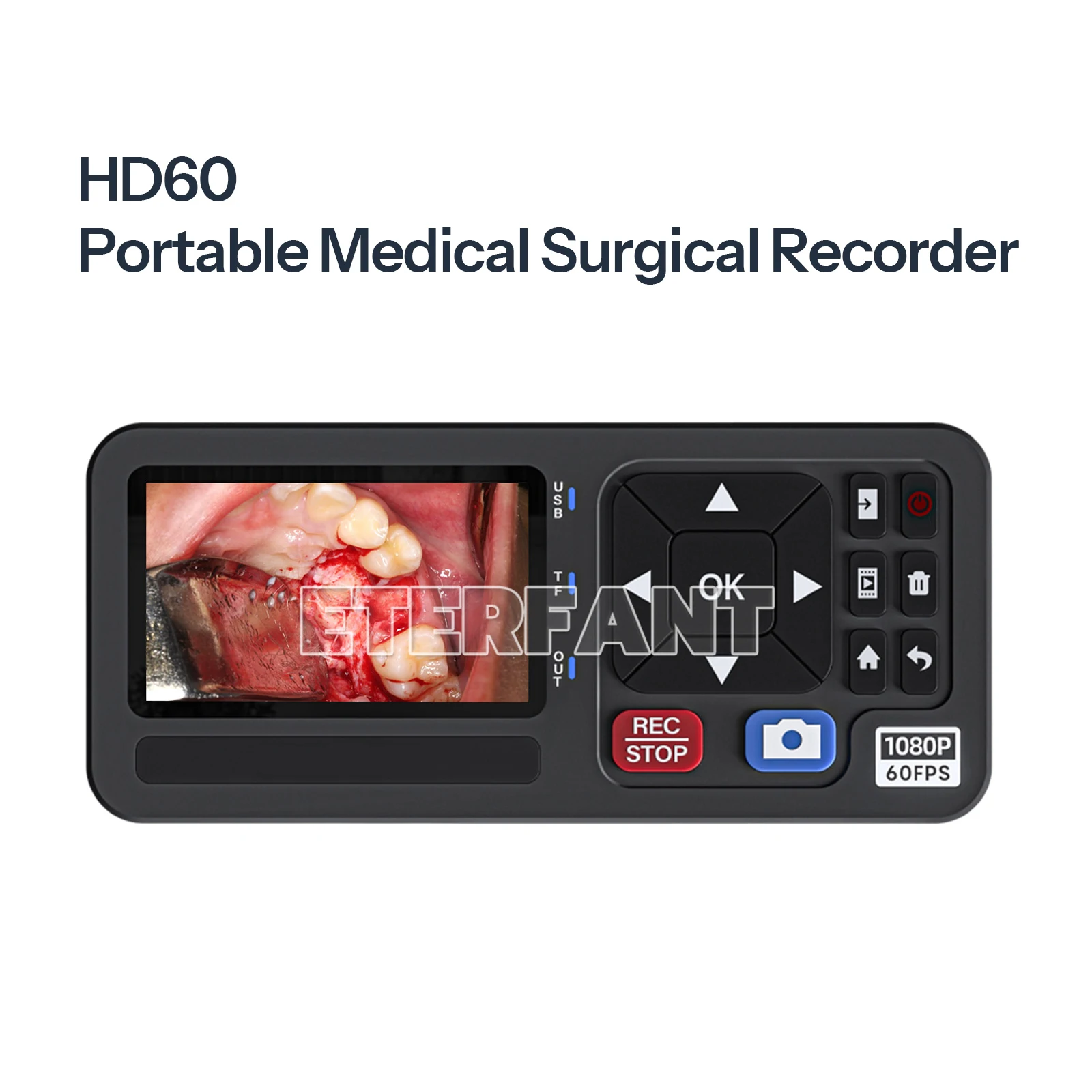 ETERFANT HDMI/VGA/YPbPr/CVBS Input Portable Medical Surgical Recorder for Laparoscopy and Endoscopy Capture 1080p60Hz Output