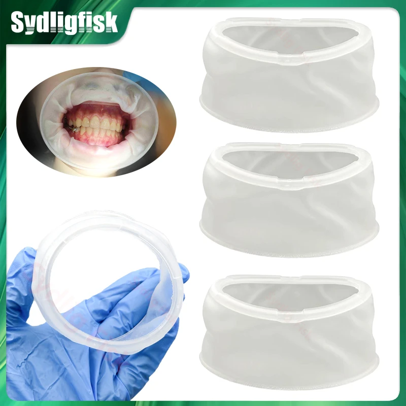 

5/10/20Pcs Dental O Shape Mouth Opener Cheek Retractors Orthodontic Oral Lip Cheek Retractor Expander Teeth Whitening Dentistry