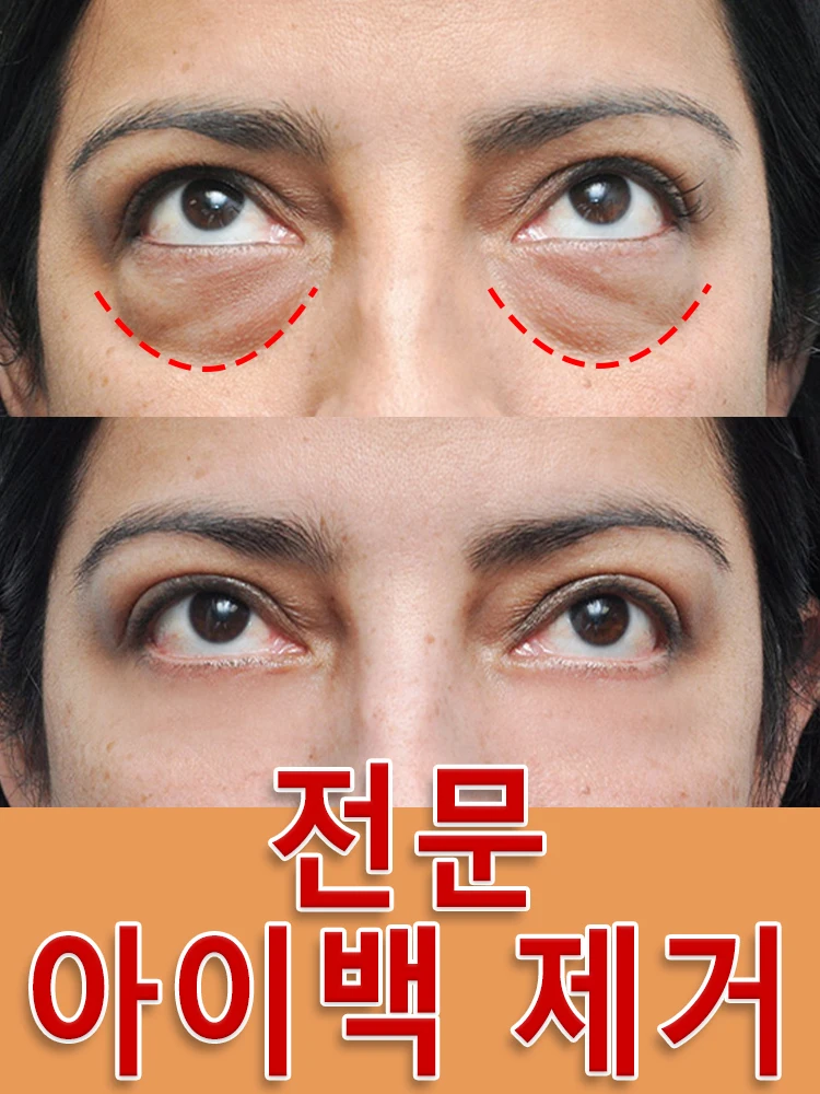 

Solving problems around the under-eye area