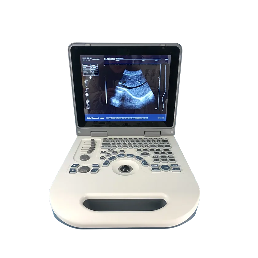 Affordable price portable ultrasound machine for facial injections fat scanning anesthesia MSK use