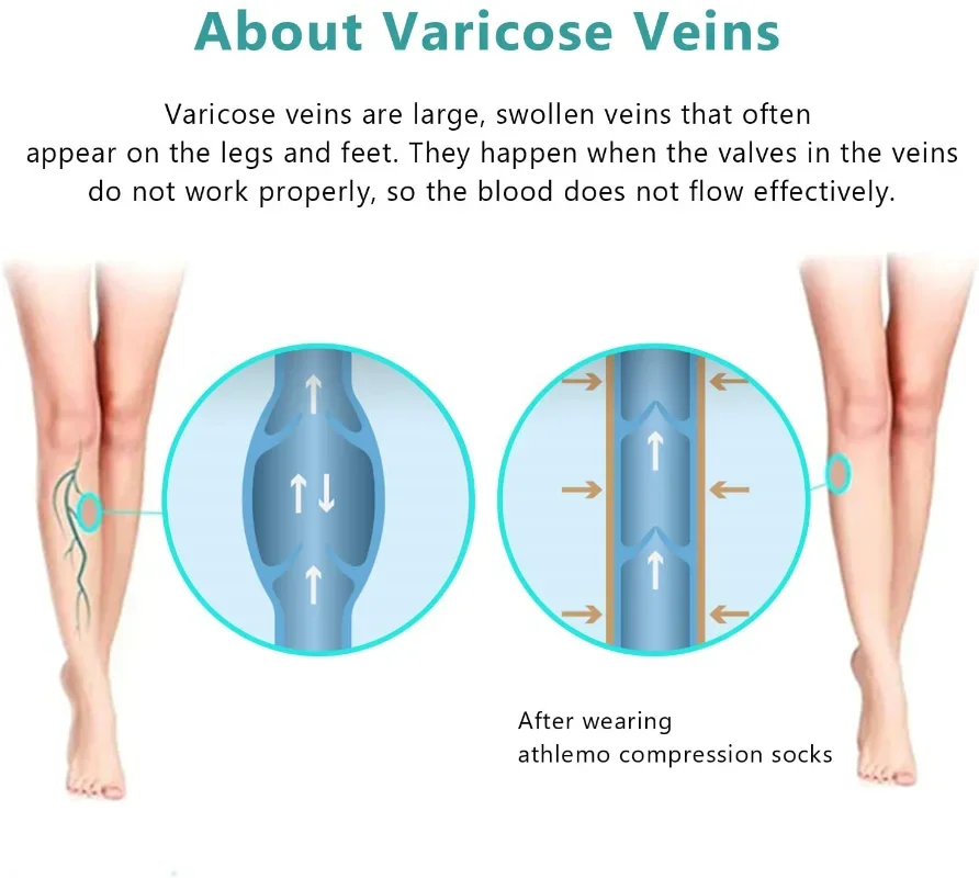 痩身用着圧パンスト 15-20mmHg 不透明 強力サポート 医療用段階着圧ストッキング 浮腫サポート用