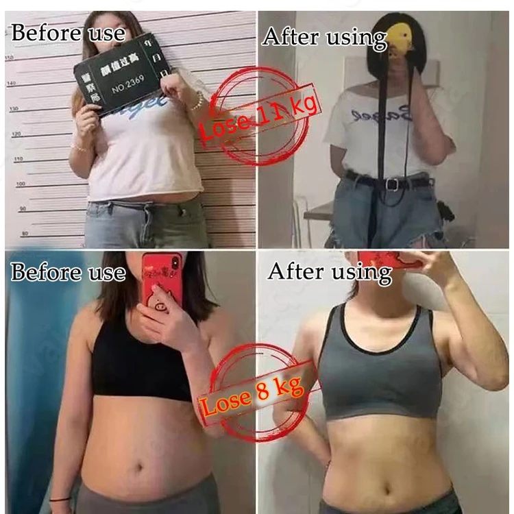 30Pcs/Box Slimming Navel Sticker Weight Lose Products Slim Patch Burning Fat Patches Weight Loss Patch Lose Weight Fast