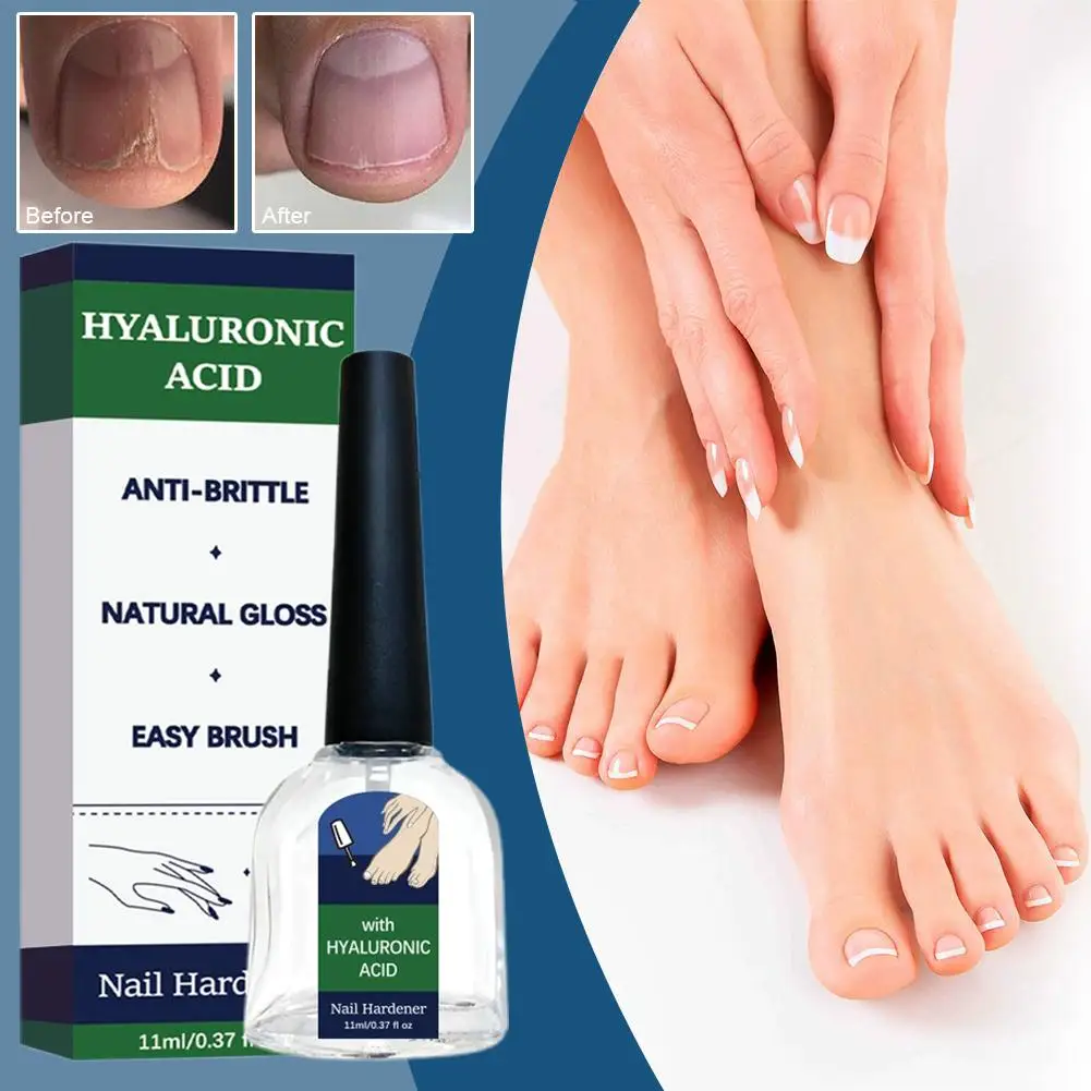 Nail Care  Intense Moisture Treatment For Hydrated, Strong Nails – Reduces Brittle Nails Nail Care Solutiaon 11ml