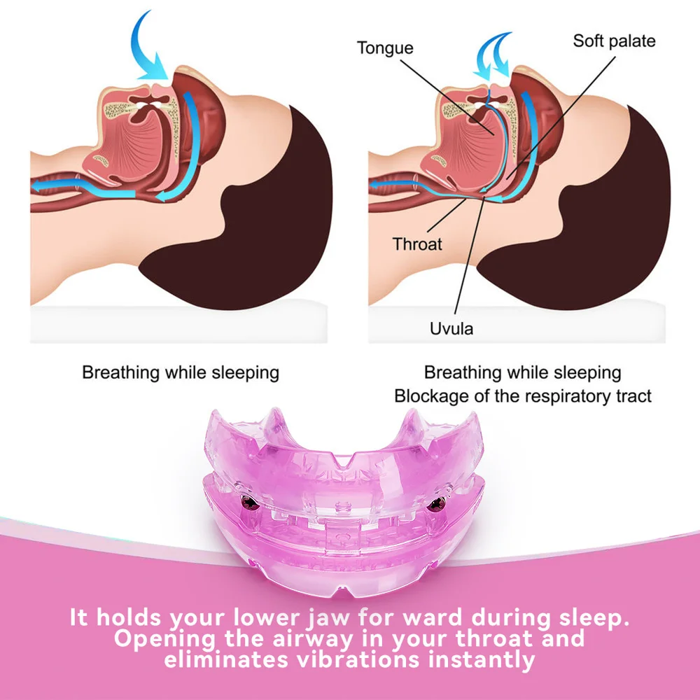 

Adjustable Anti Snoring Mouthpiece Device Snoring Stopper Teeth Mouthguard Bruxism Improve Sleep Quality Buck Teeth Correction