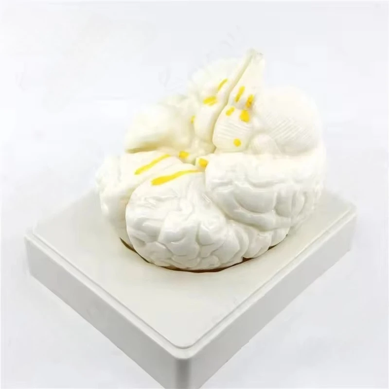 

4D Assembly Brain Anatomy Model Medical Science Education Cerebrovascular Artery Neurological Human Brain Anatomy Model