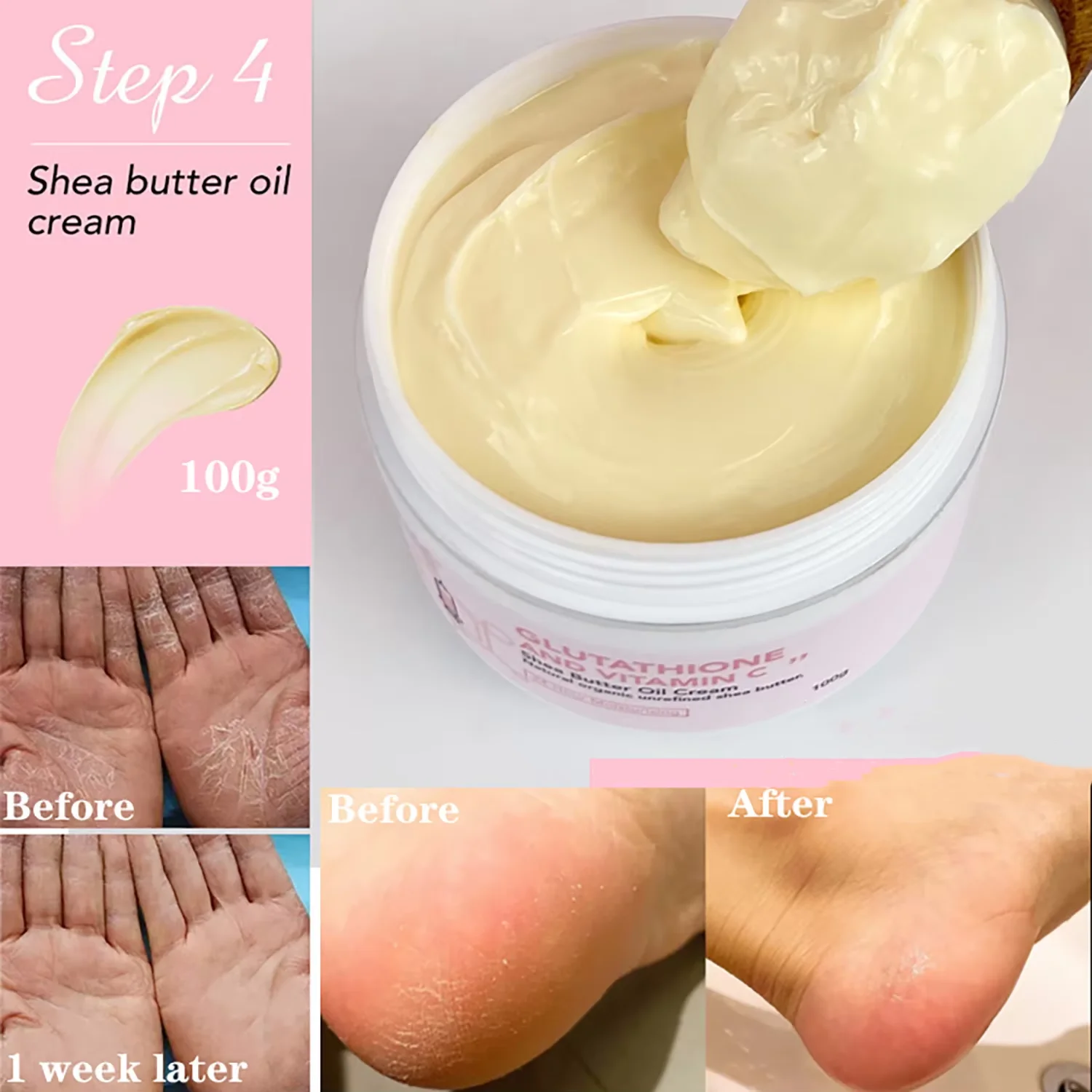 كريم AILKE لتفتيح وتبييض البشر - مراجعة Shea Butter Raw وسعره