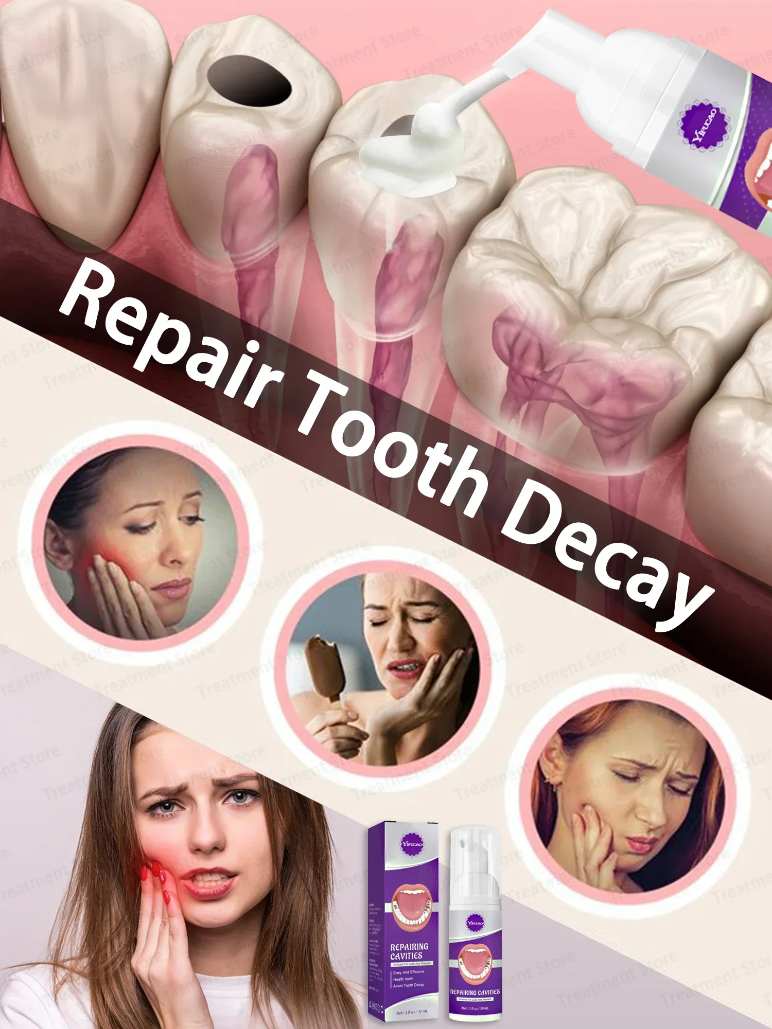 Anti Decay Toothpaste Dental Caries Repair Serum Prevent Tooth Decay Protect Teeth 30ml