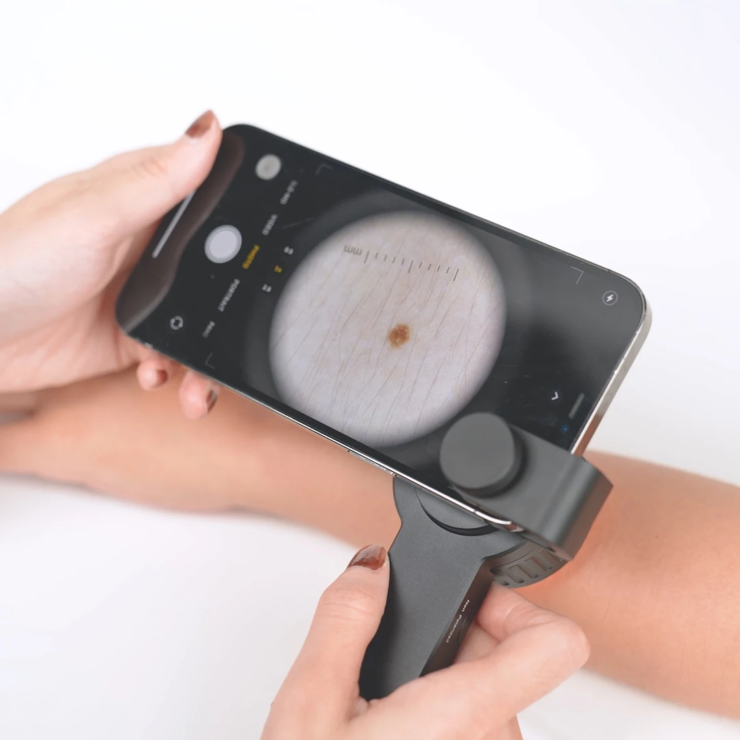 Medical Imaging DE-3100 PRO Derma Scope Cross-polarised Light Dermatoscope