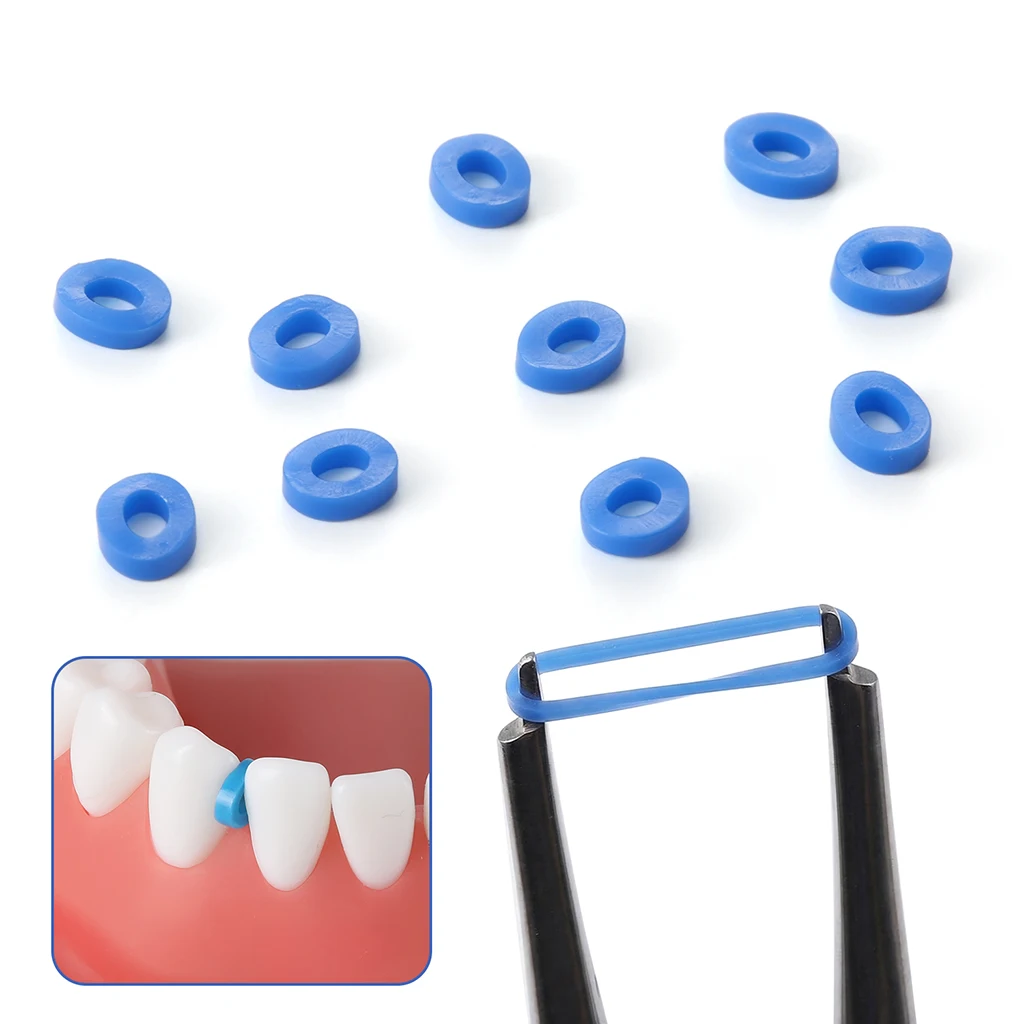 1000 Stück/Packung AZDENT Dental Kieferorthopädische Separatorbänder Elastische Gummibänder Zahnmedizinisches Material zur Erweiterung des Zahnraums – Detail 7