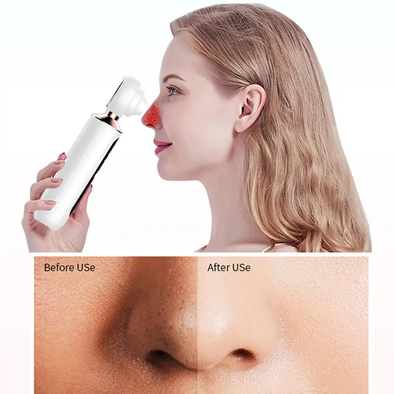 Cura della pelle Detergente per pori Strumenti di bellezza per aspirapolvere per la rimozione dei punti neri visivi
