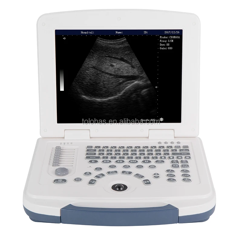 

LHA580 Ultrasound Instruments Laptop Clinic Portable Other Ultrasonic Equipment B/W Scanner