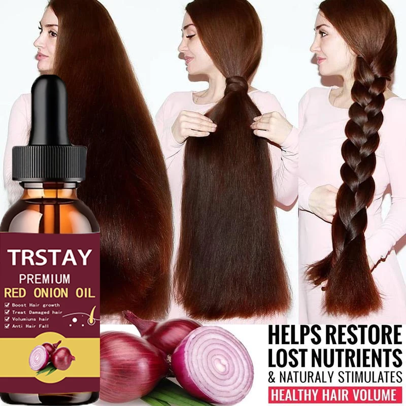 Hair Grouth Fast Onion Black Seed Essential Oils Oil Spray for Hair Care and Growth To Prevent Hair Loss