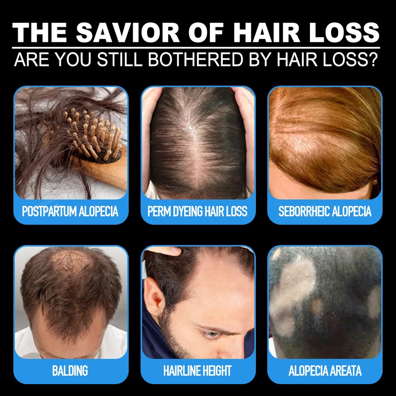 3/5 قطعة أندريا زيت نمو الشعر جوهر سماكة لنمو الشعر مصل تساقط الشعر المنتج 100% مستخلص نباتي طبيعي سائل 20 مللي #4