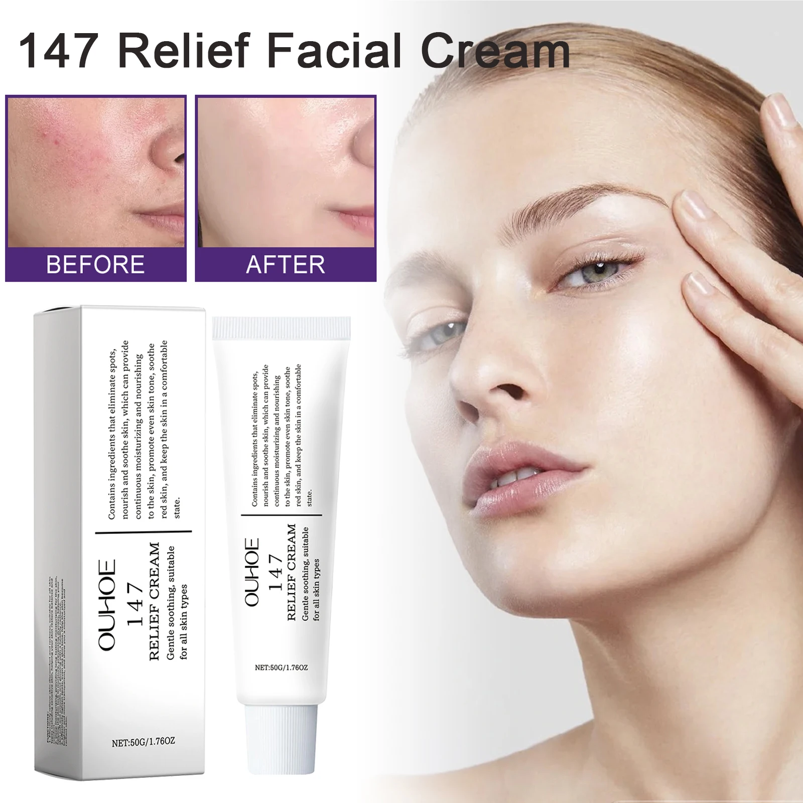 147 solução de creme de alívio para problemas de pele anti-açúcar e antioxidante endereço manchas nutrir hidratante de longa duração coreano