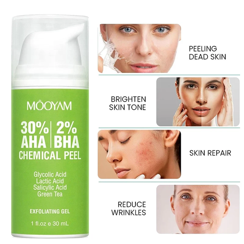 glycolic acid 30 gel peel