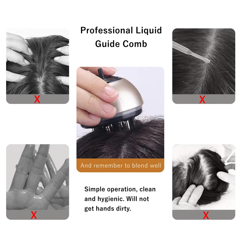 Roll-On Applicator Minoxidil Scalp Essence Massage Comb Stainless Steel Promote Hair Growth Absorption Head Massager Relaxer