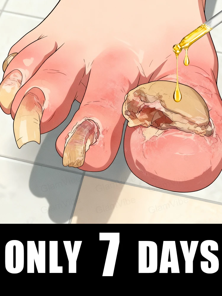 

Qᴜɪᴄᴋʟʏ ᴇʟɪᴍɪɴᴀᴛᴇ ғᴜɴɢᴜs ᴀɴᴅ ʀᴇsᴛᴏʀᴇ ʜᴇᴀʟᴛʜʏ ɴᴀɪʟs