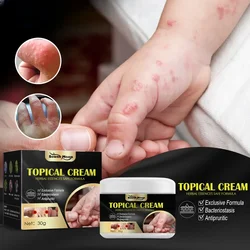 Professional Hand foot antipruritic ointment skin dry Treatment mosquito bite Anti itch topical cream Herbal Plaster Skin Care