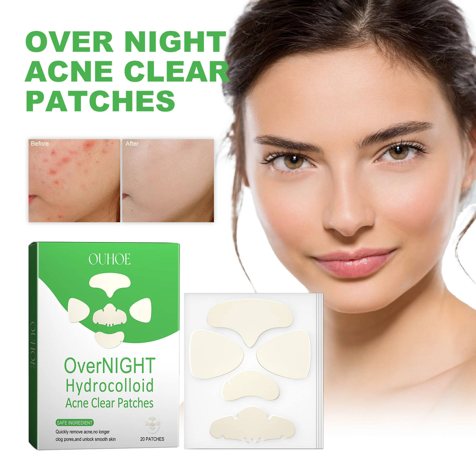 Over Night Hydrocolloid Acne Clear Patches New Design Forehead Nose Chin Reduces Inflammation Quickly Remove Acne Pimple Patch