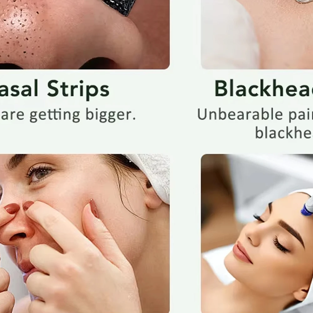 スキンスクラバー ディープフェイスクリーニング ピーリング 黒ずみ除去 フェイシャルシャベル クレンザー リフティングスキンケア フェイシャルディープクリーニングマシン