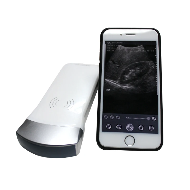 3 in 1 Portable wireless ultrasound probe smartphone wifi linear Handheld ultrasound doppler for medical