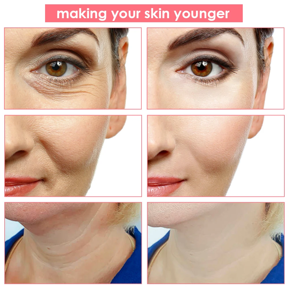 5 kolorów maszyna do liftingu twarzy urządzenie kosmetyczne o częstotliwości radiowej EMS mikro-prądowy masażer do skóry