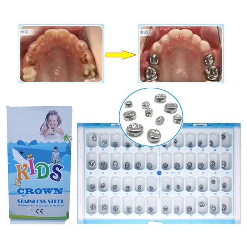 48/96Pcs Dental Kids Primary Molar Crowns Stainless Steel 1st 2nd Molar Pediatric Posterior Temporary Crown Upper Lower