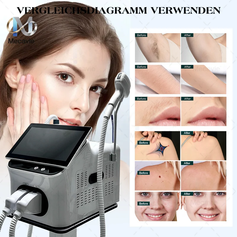 2026 Global Premiere: FAC's New Diode Laser Two-in-One Painless Permanent Hair Removal and Tattoo Removal - A Salon Essential