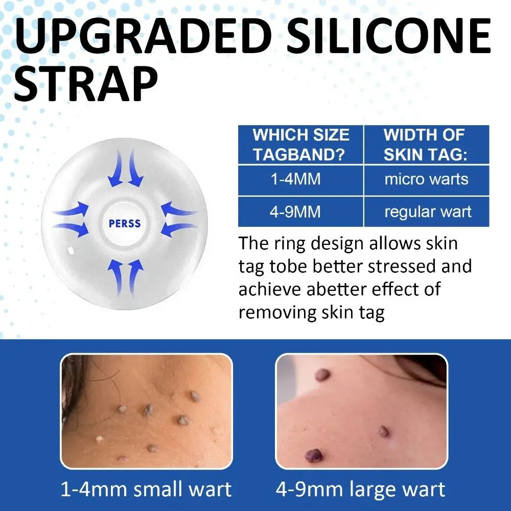 ใหม่ 2-IN-1 Skin Tag Removal เครื่องมือไม่เจ็บปวด ABS Mole สิวกําจัดหูดปากกาทําความสะอาด Swabs Facial Skin Care เครื่องมือผิว