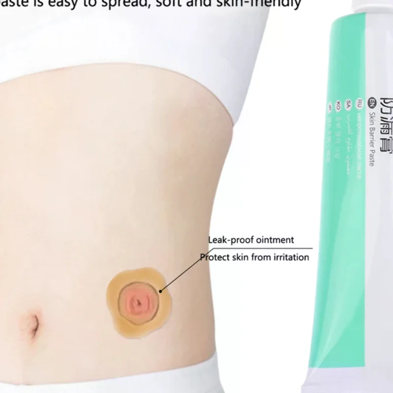 

60g Skin Care Powder Stoma Accessories After Surgery Cream Tool Barrier Paste Leak-proof For Ostomy Bag Anti Ointment