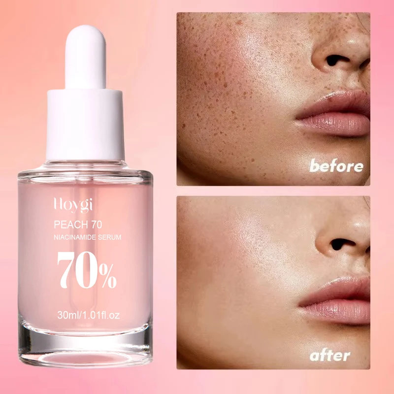 Perzik 70% Niacinamide Serum 30ml Hydraterende Voorkomen Droogheid Facial Essentiële Olie Toenemende Elasticiteit Glad Verzachten Huidverzorging