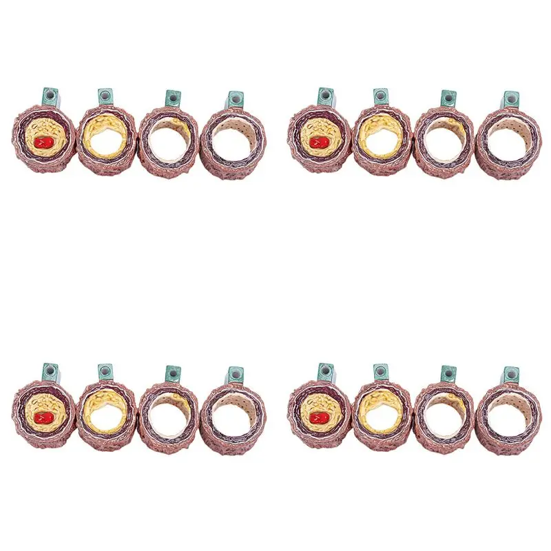 4X Atherosclerosis Thrombosis Model Vascular Disease Demonstration Heart Vascular Pathology Model