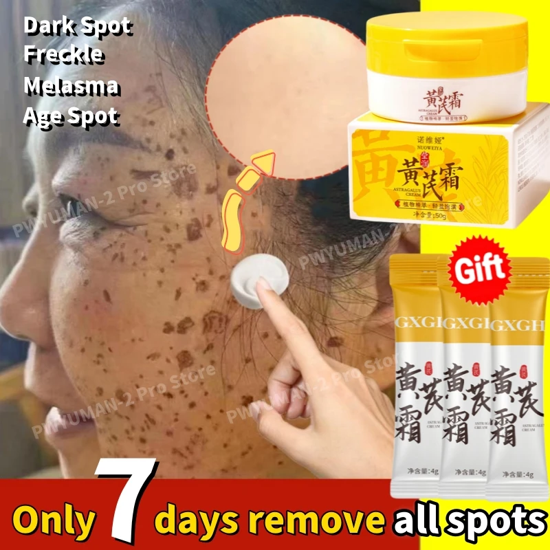 Astragalus Whitening Freckle Cream Brighten Black Skin Fast Remove Dark Spot Melasma Fade Melanin Acne Scars Anti-aging SkinCare