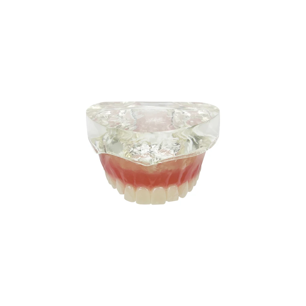 Maxillary Dental Implant Model For Education Studying Upper Jaw Teeth Model Dental Teaching Tooth Models Dentistry Overdenture