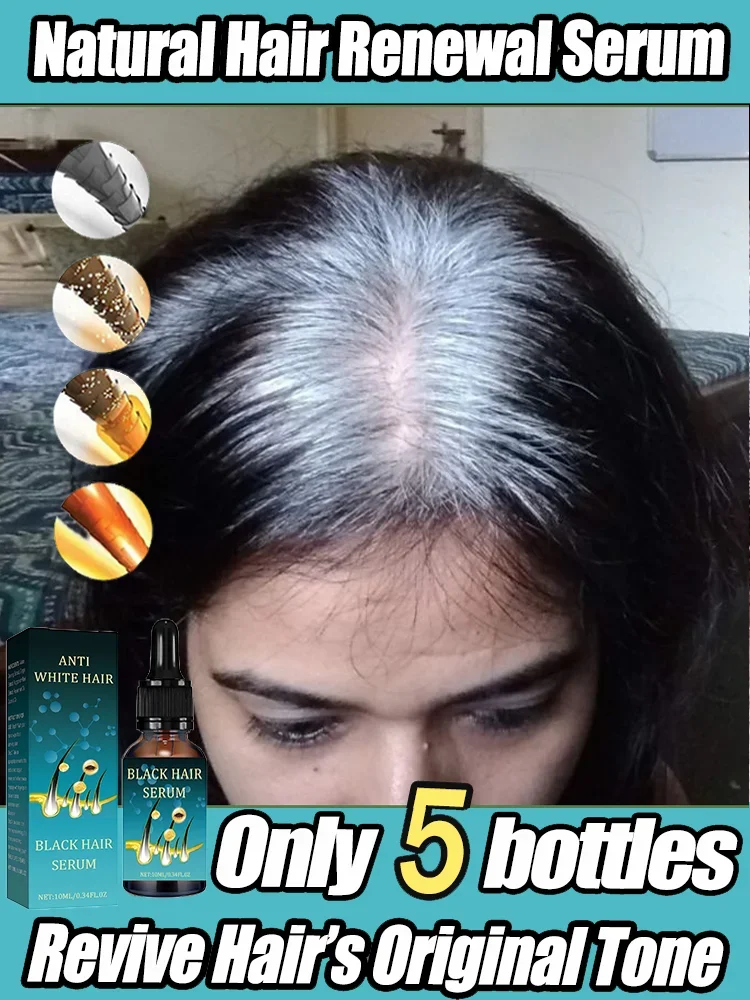 Natural and Healthy White To Black hair No hair color,no allergies Anti-grey quickly turns white hair into black repairs natural